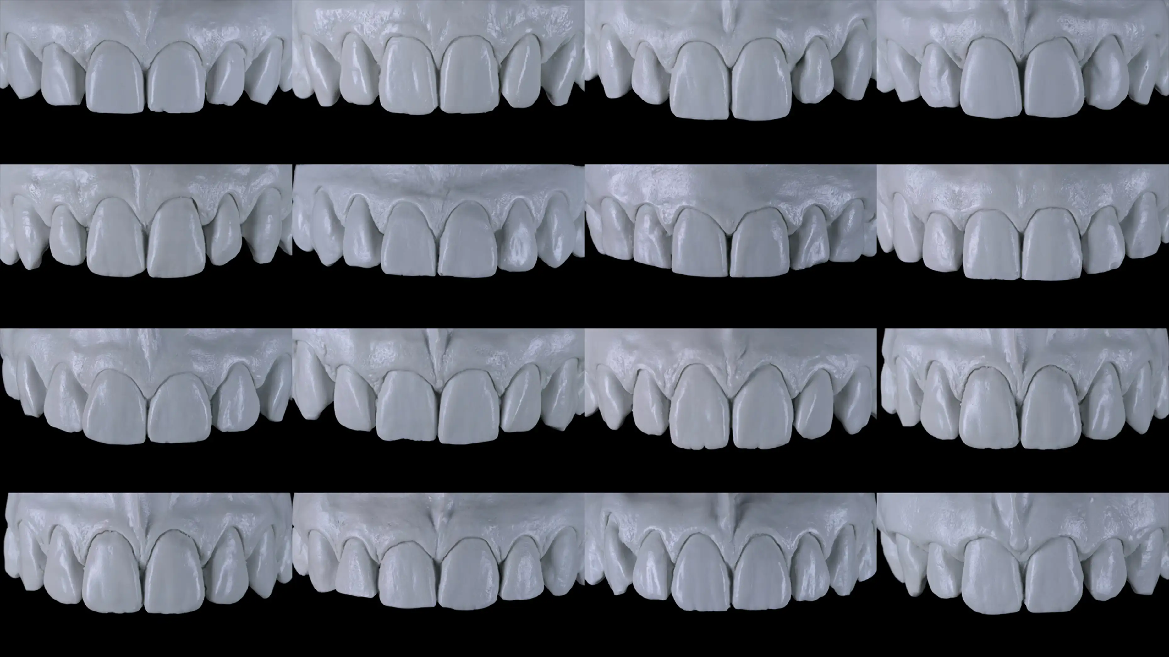 서울심도치과의원 | 충치치료 검사