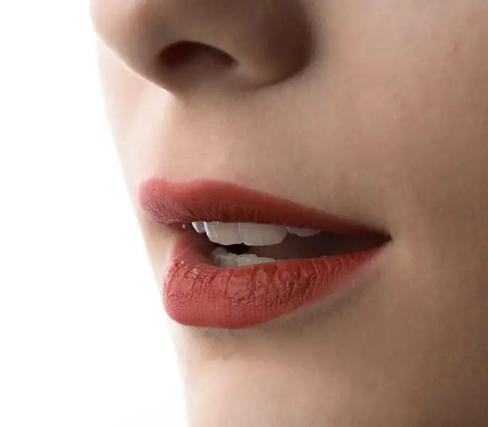 서울심도치과의원 | 앞니재치료 심미 보철