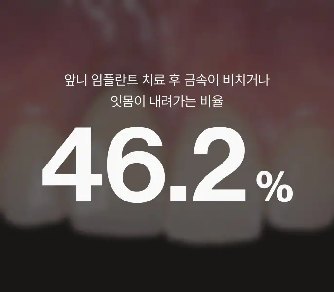 서울심도치과의원 | 앞니재치료 앞니임플란트