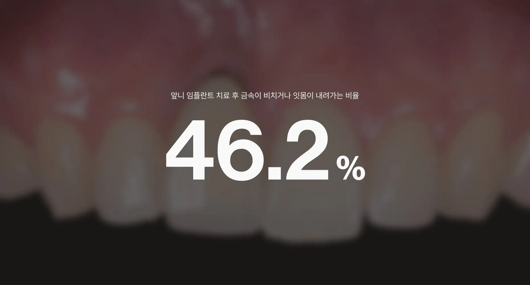 서울심도치과의원 | 앞니재치료 앞니임플란트