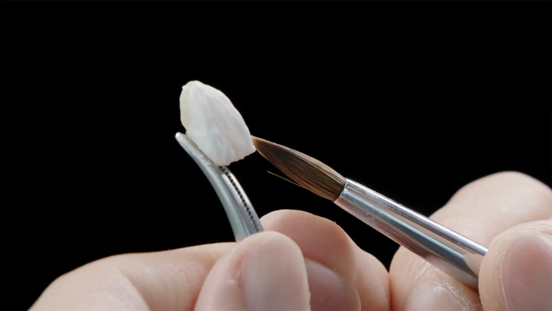 서울심도치과의원 앞니재치료 라미네이트 | 다층 포세린 빌드업 기법