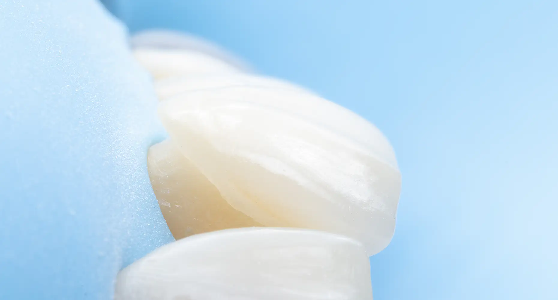 서울심도치과의원 | 앞니재치료 라미네이트