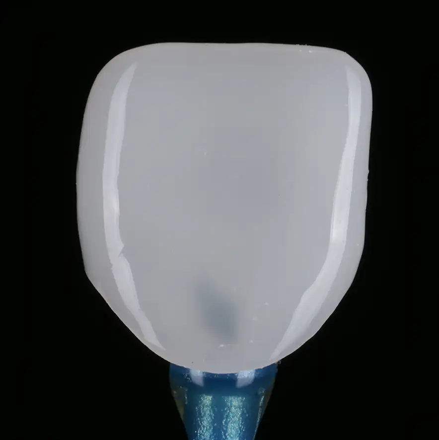 서울심도치과의원 앞니재치료 심미 보철 | 보존적 심미 수복