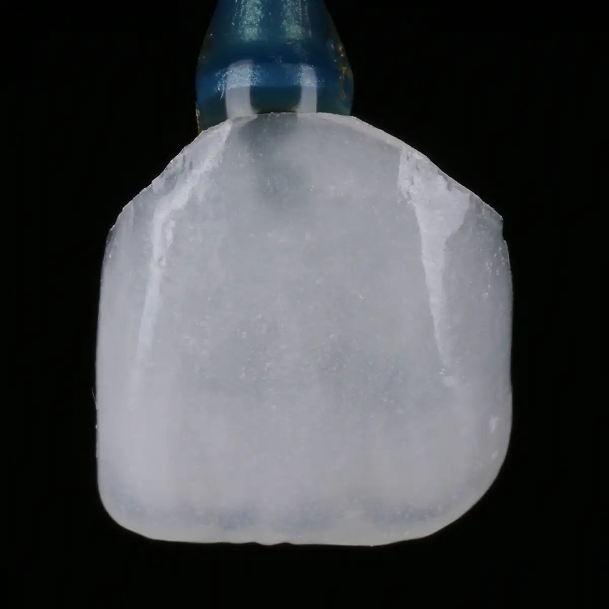 서울심도치과의원 앞니재치료 라미네이트 | 다층 포세린 빌드업 라미네이트