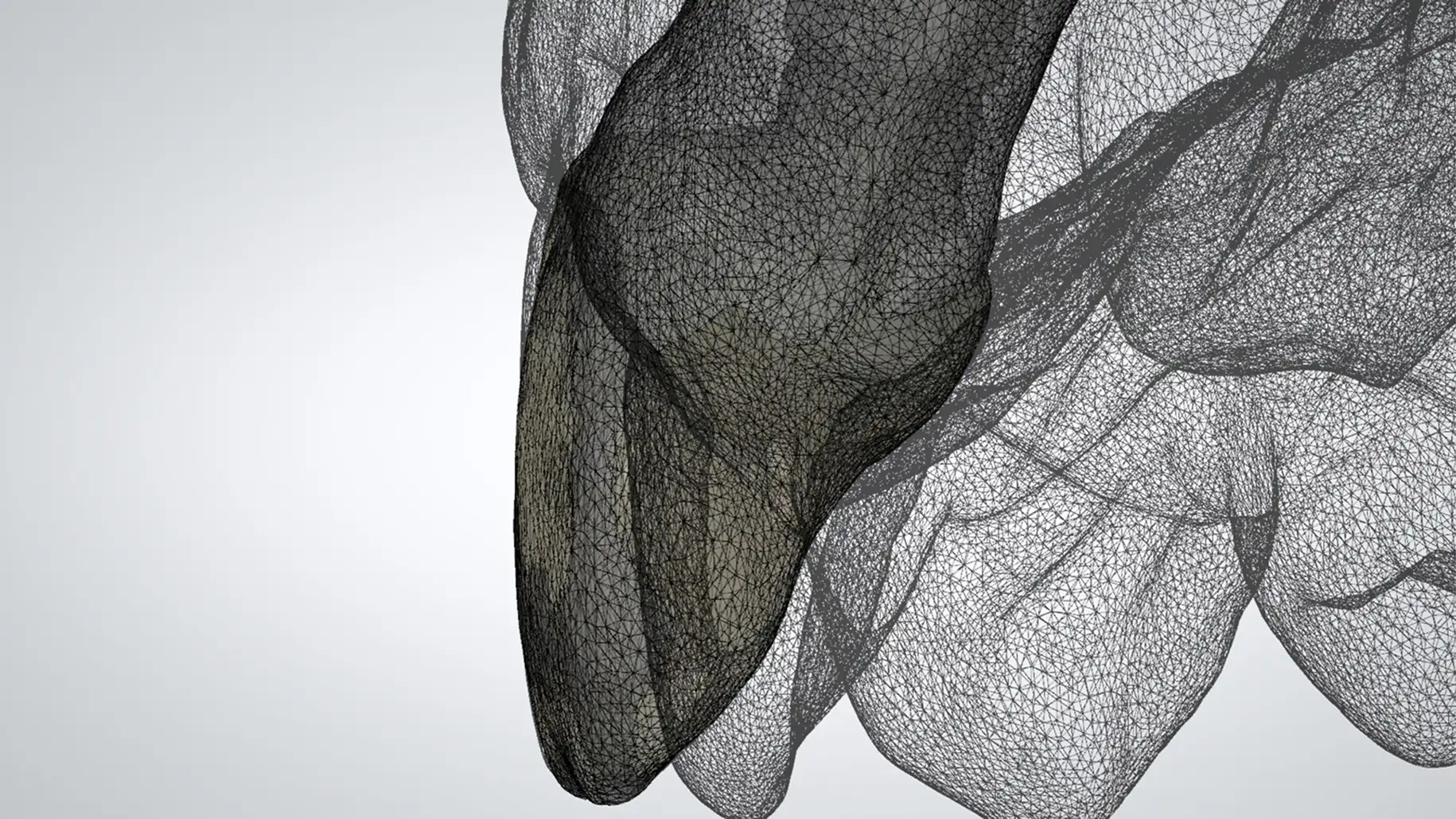 서울심도치과의원 앞니 임플란트 | 최신 연조직 수술, 정밀 보철 조정, 잇몸 볼륨 보완, 안정적인 잇몸 라인 회복