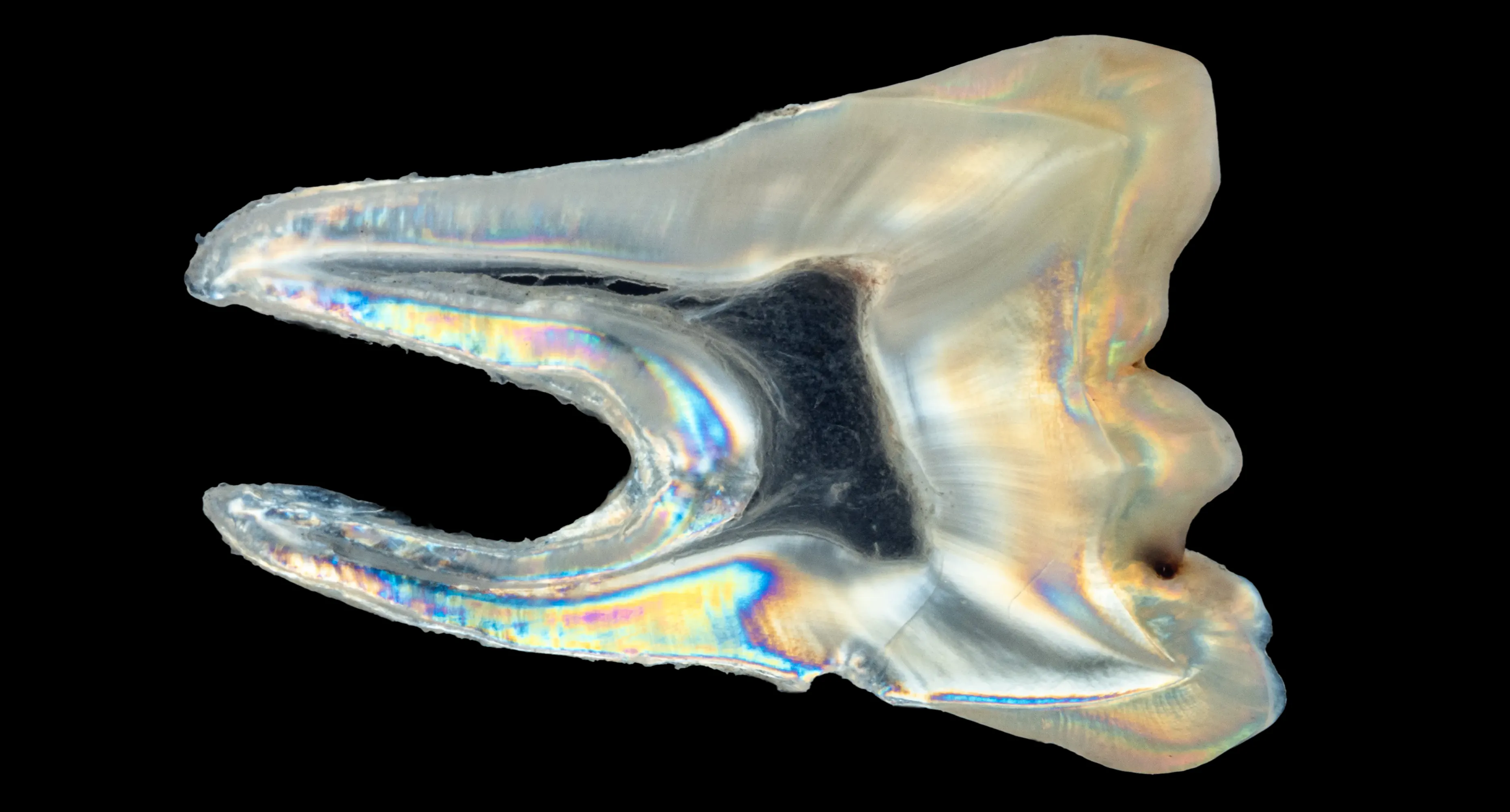 심도치과는 자연치아를 지키기 위해 더 깊이 분석합니다