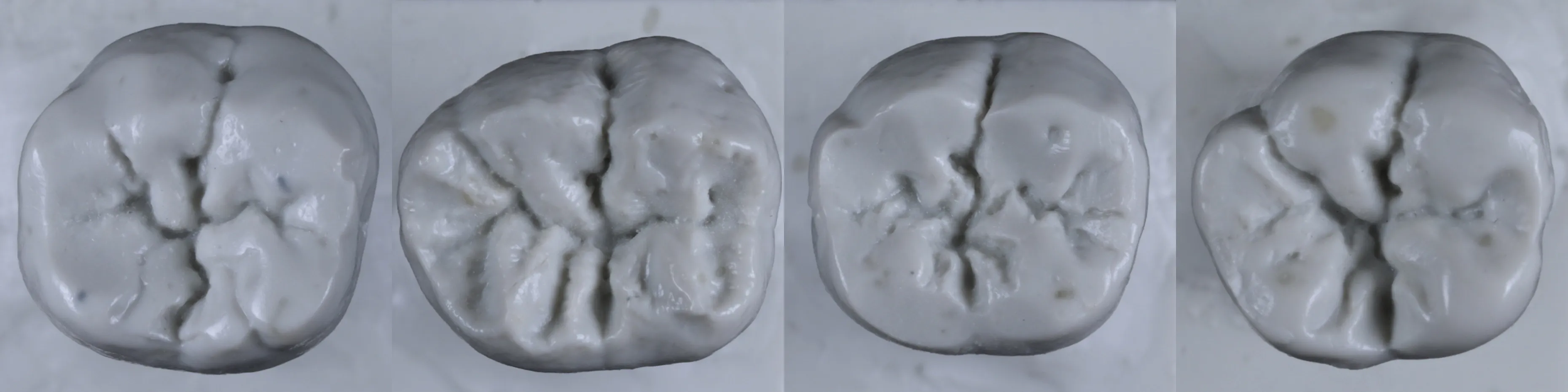 자연치아 형태 기능