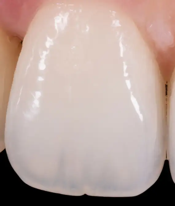 치아 색, 내부 구조 자연의 설계 정교