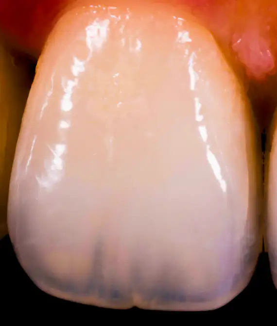 치아 색, 내부 구조 자연의 설계 정교