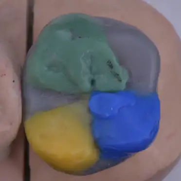 자연치아 편안하고 안정된 기능 | 환자 개개인에게 꼭 맞는 기능적 회복을 제공