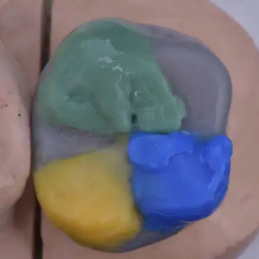 자연치아 편안하고 안정된 기능 | 환자 개개인에게 꼭 맞는 기능적 회복을 제공