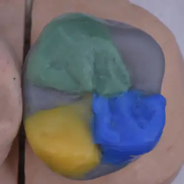 자연치아 편안하고 안정된 기능 | 환자 개개인에게 꼭 맞는 기능적 회복을 제공