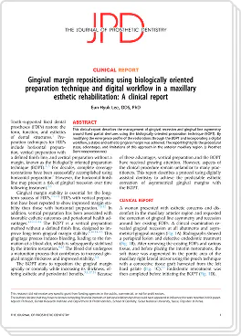 심미 보철 치료 논문 이미지