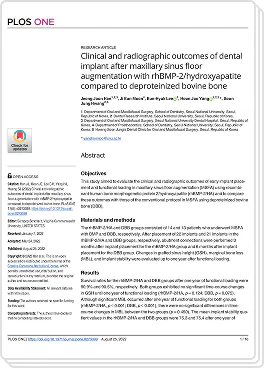 임플란트를 위한 상악동 거상술 (뼈이식술) 논문 이미지