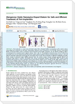 임플란트 주위염 치료 논문 이미지
