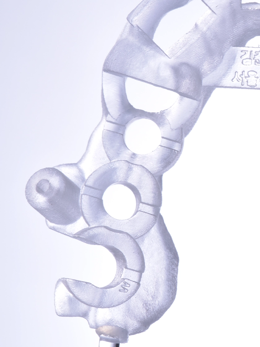 앞니 임플란트의 식립 위치와 각도, 성공의 핵심 포인트